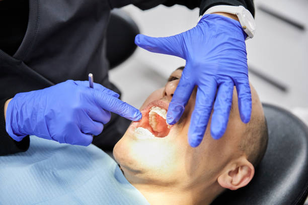 Best Lost Filling or Crown Replacement in Fremont, MI